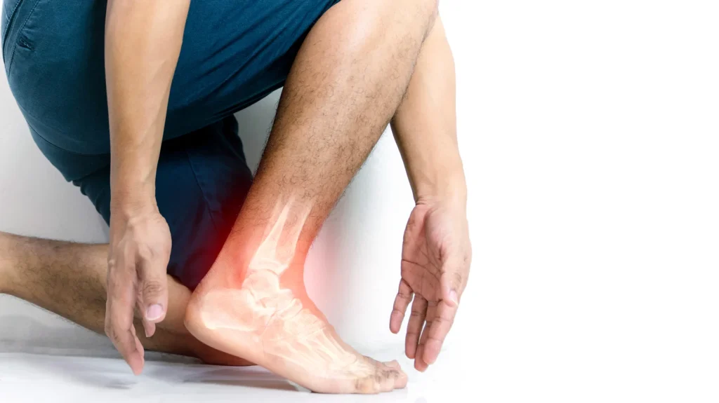 Ankle Instability