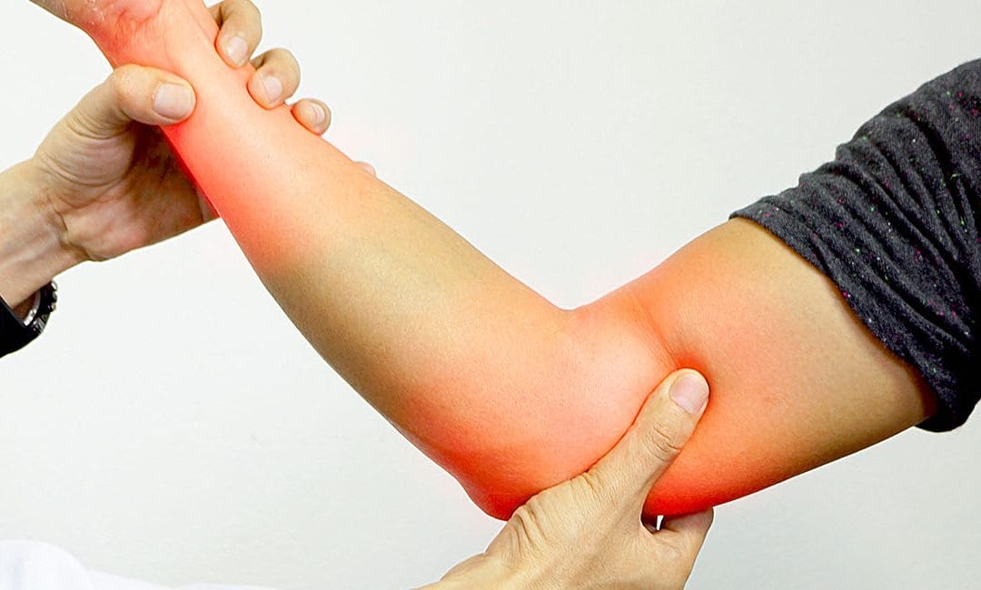 Elbow Arthritis