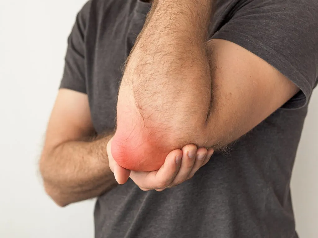 Elbow Bursitis