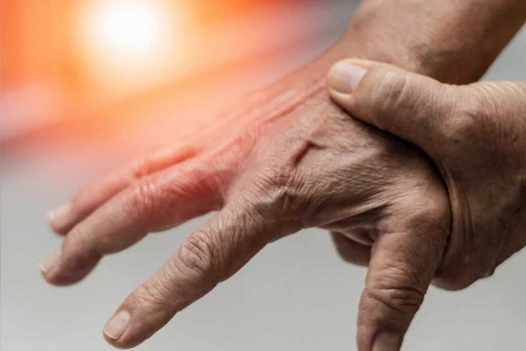 Flexor Tendon