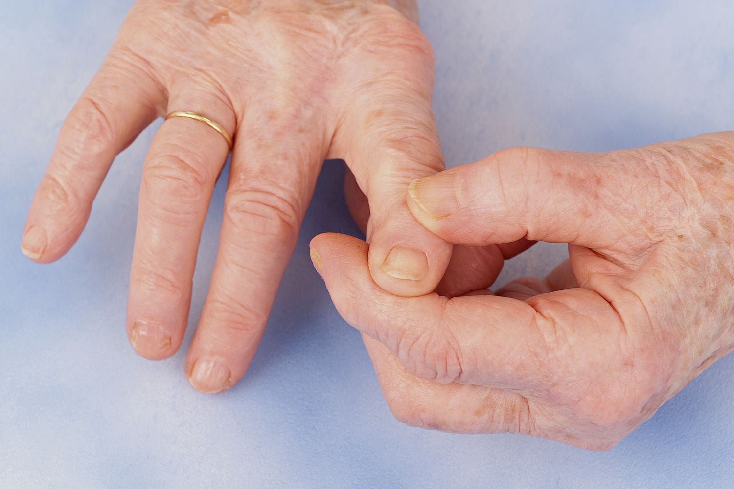 Osteoarthritis of the Hand