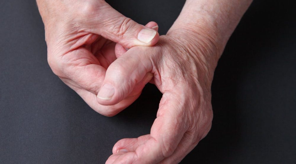 Arthritis at the Base of the Thumb