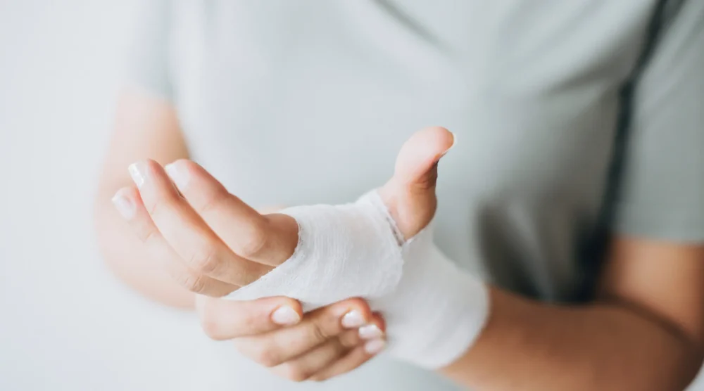 Hand Fracture