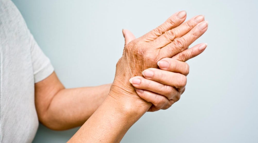 Elderly woman with Arthritis in her hands