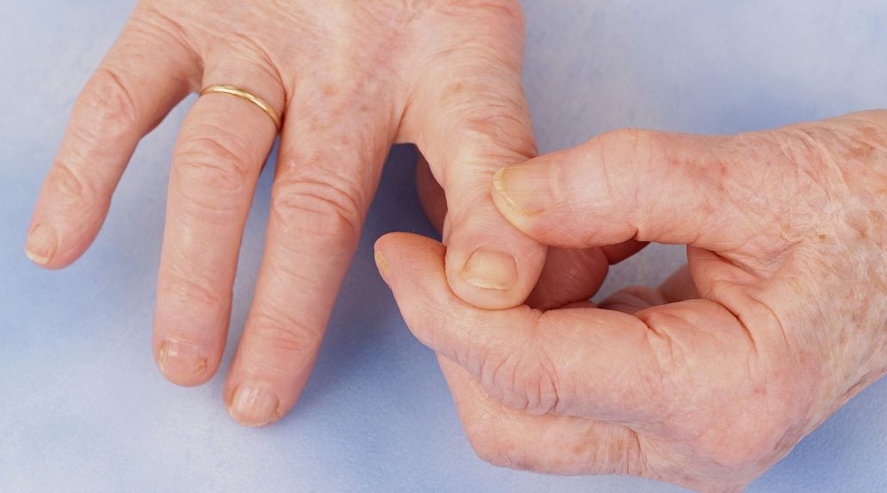 Osteoarthritis of the Hand